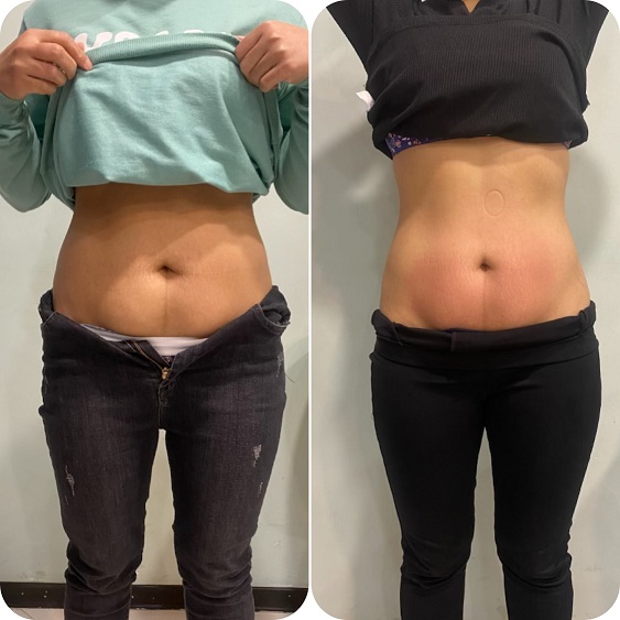 کلاینت کاهش سایز