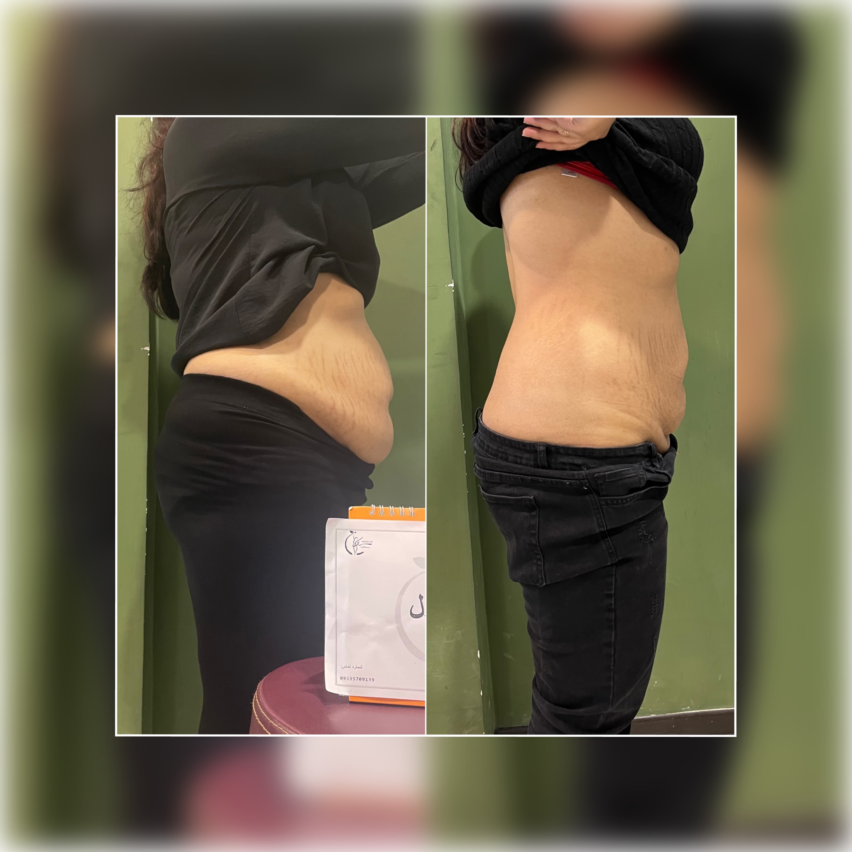 کلاینت کاهش سایز و وزن